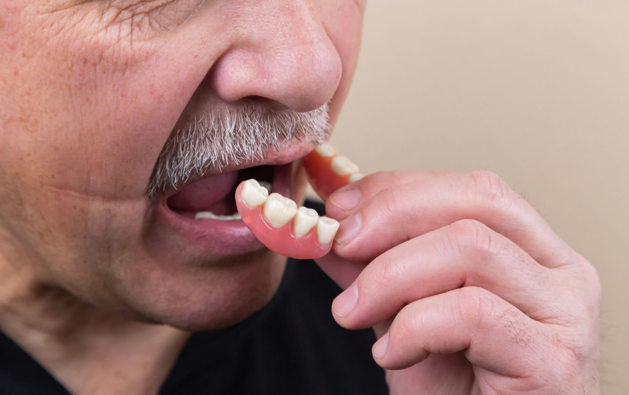 Digital Dentures and Partials: A Modern Approach to Restoring Your Smile